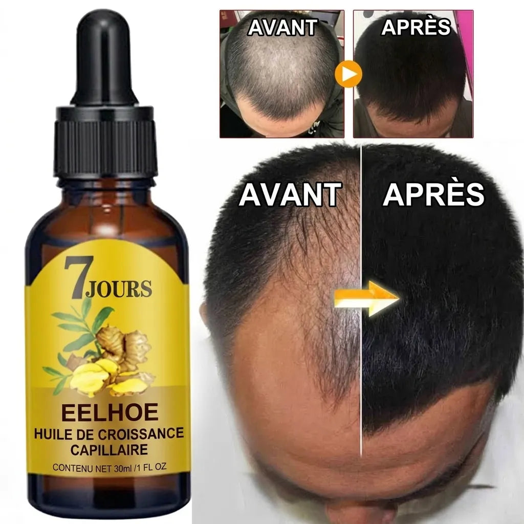Ginger Hair | Huile pour la croissance des cheveux et le traitement de la calvitie | Veiggara