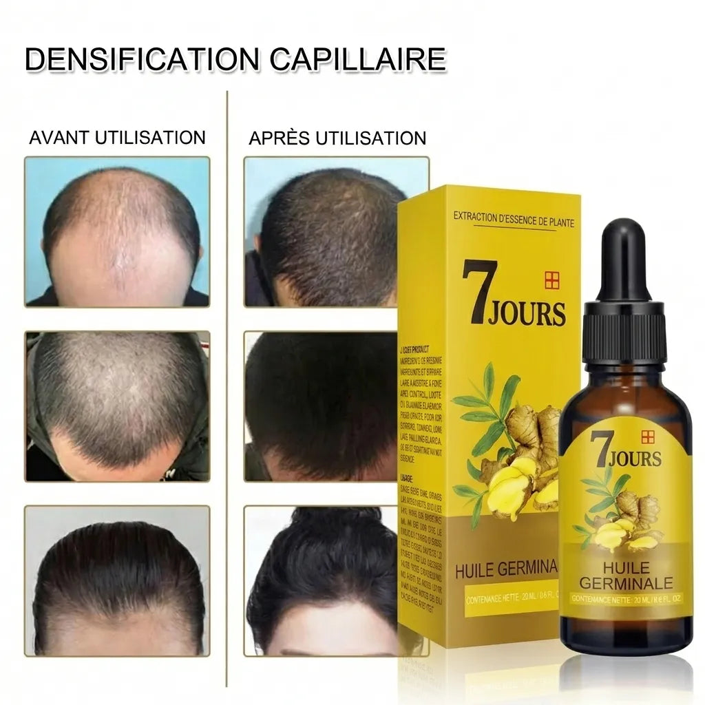 Ginger Hair | Huile pour la croissance des cheveux et le traitement de la calvitie | Veiggara
