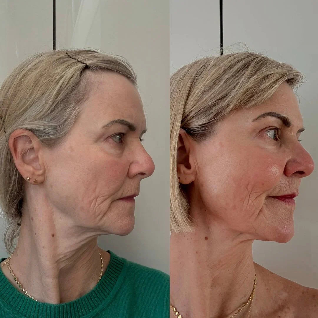 Crema lifting anti-età Gua Sha | Veiggara