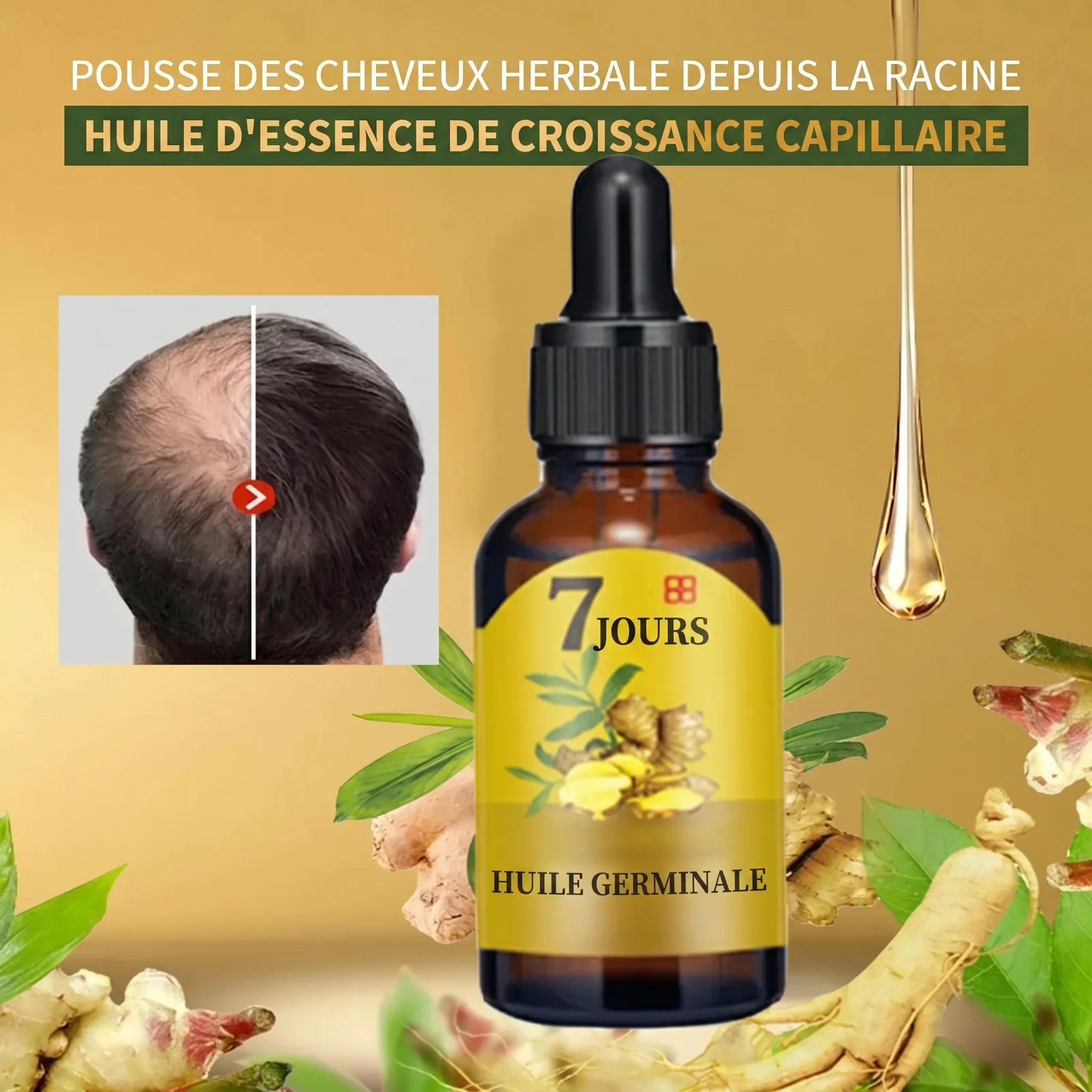 Ginger Hair | Huile pour la croissance des cheveux et le traitement de la calvitie | Veiggara