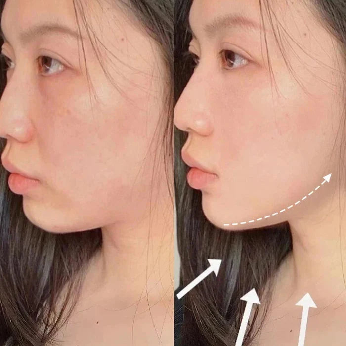 V-Revita™ - Masque facial pour réduire le double menton et les rides | Veiggara