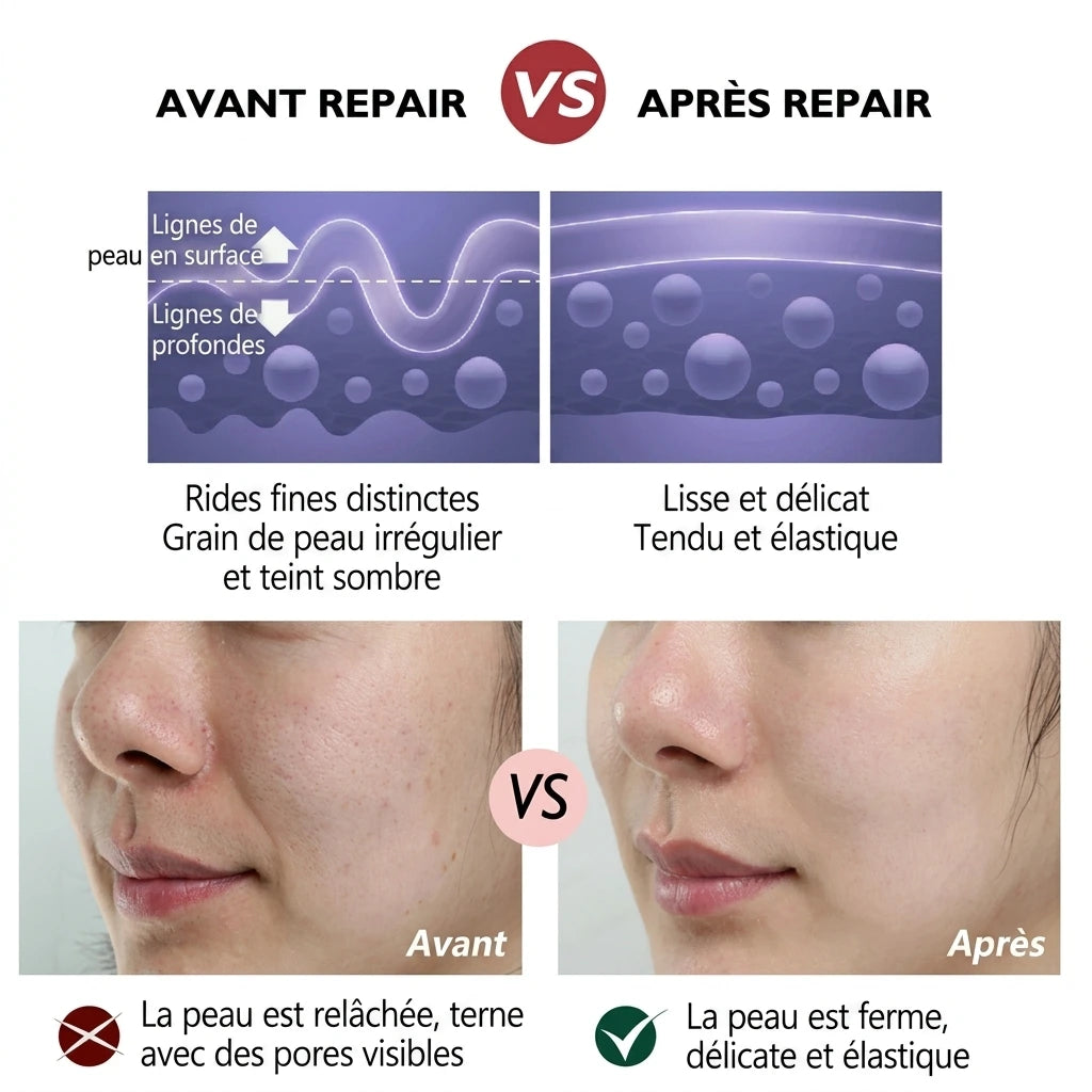 Crème anti-âge au rétinol [Achetez-en 2, obtenez-en 3] - Veiggara