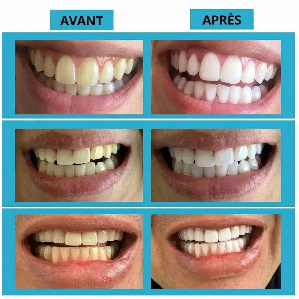Polvere detergente e sbiancante per denti | Veiggara