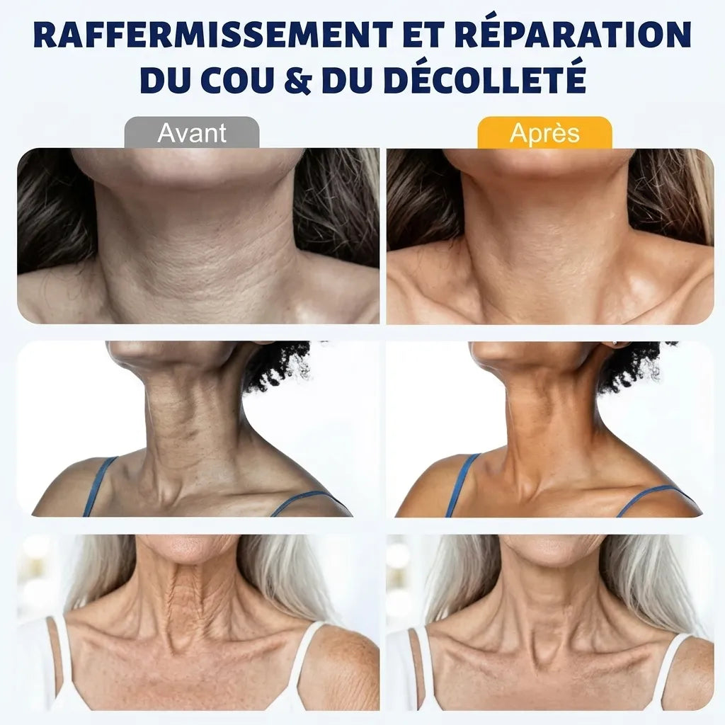 FirmSkin Neck™ - Crema collo al collagene e acido ialuronico | Veiggara